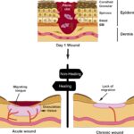 Can Brake Fluid Aid in Wound Healing?