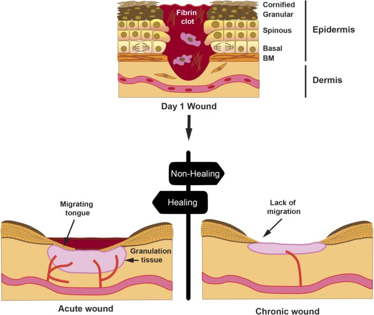 Can Brake Fluid Aid in Wound Healing?